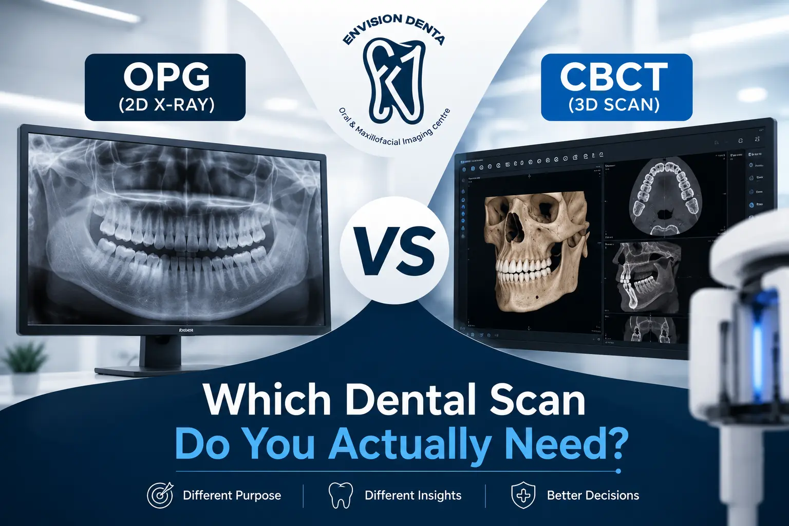 OPG vs CBCT: Which Dental Scan Do You Actually Need?